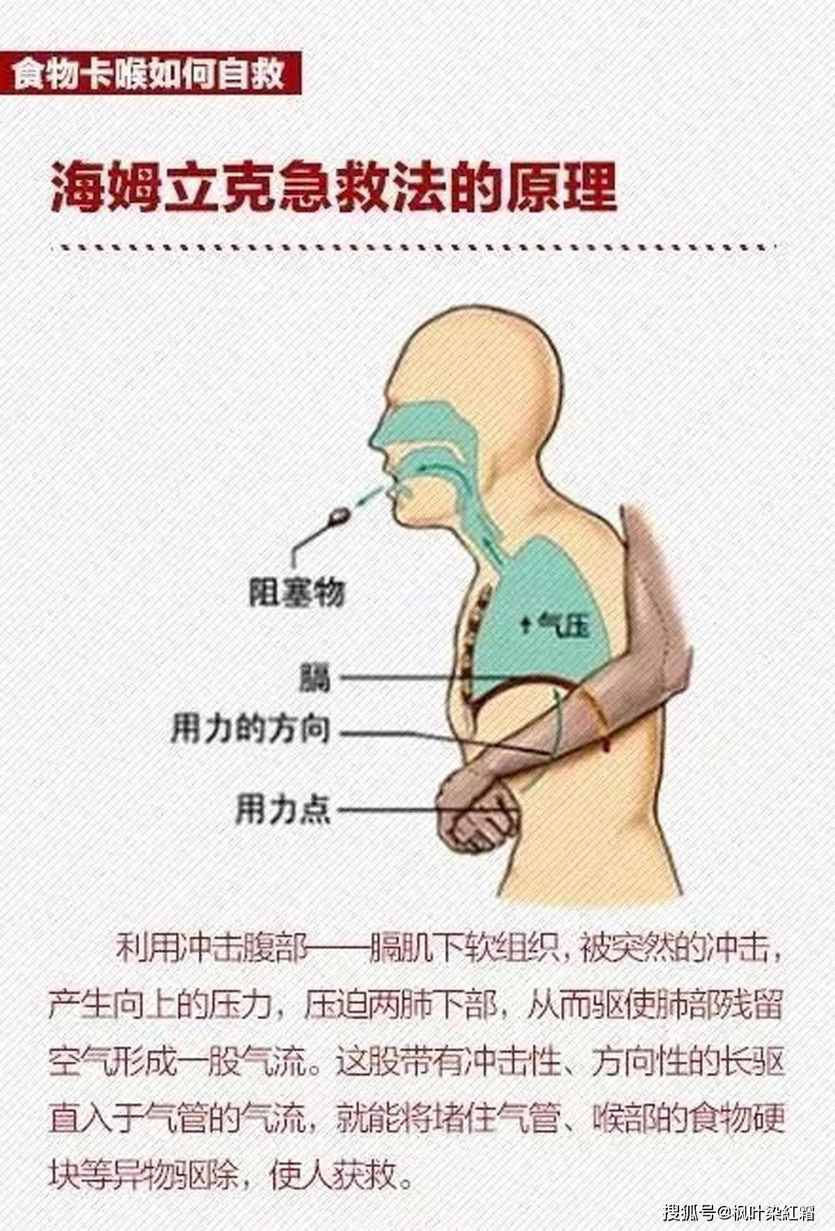 急性腹痛的紧急处理与急救技巧指南